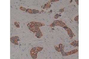 Immunohistochemistry (IHC) image for anti-ATP-Binding Cassette, Sub-Family C (CFTR/MRP), Member 11 (ABCC11) (AA 1141-1382) antibody (ABIN1866476)