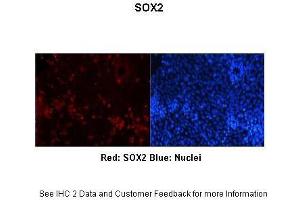 Immunohistochemistry (IHC) image for anti-SRY (Sex Determining Region Y)-Box 2 (SOX2) (N-Term) antibody (ABIN2777428)