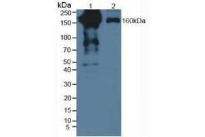 Western blot analysis of (1) Human Serum and (2) Human Lung Tissue. (PZP 抗体  (AA 1212-1391))