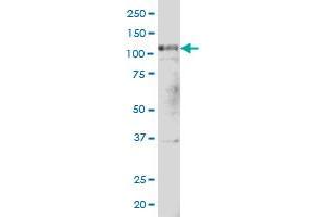 PTK2 monoclonal antibody (M02), clone 1C1 Western Blot analysis of PTK2 expression in Hela S3 NE . (FAK 抗体  (AA 355-490))