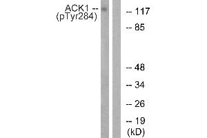 Western blot analysis of extracts from HepG2 cells, treated with EGF (200 ng/mL, 30 mins), using ACK1 (Phospho-Tyr284) antibody. (TNK2 抗体  (pTyr284))