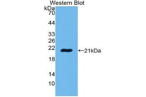 Western blot analysis of the recombinant protein. (POTEG 抗体  (AA 177-330))