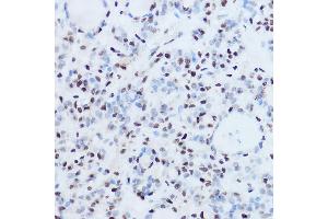 Immunohistochemistry (IHC) image for anti-Sjogren Syndrome Antigen B (SSB) (AA 166-408) antibody (ABIN3015265)