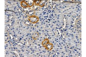 ABIN6262753 and ABIN6279177 at 1/100 staining mouse kidney tissue by IHC-P.