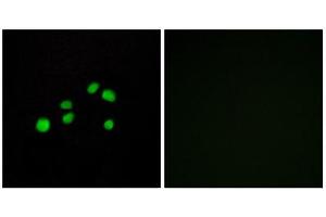 Immunofluorescence (IF) image for anti-Collagen, Type XXIII, alpha 1 (COL23A1) (C-Term) antibody (ABIN1850316) (COL23A1 抗体  (C-Term))