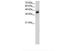 Image no. 1 for anti-Microtubule Associated Tumor Suppressor 1 (MTUS1) (AA 90-139) antibody (ABIN205046) (MTUS1 抗体  (AA 90-139))