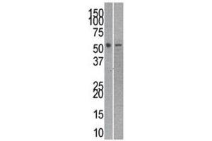 Reptin antibody used in western blot to detect RUVBL2 in mouse kidney (left) and SK-Br-3 (right) lysate (RUVBL2 抗体  (AA 400-430))