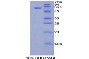 SDS-PAGE analysis of Human CILP Protein. (CILP 蛋白)