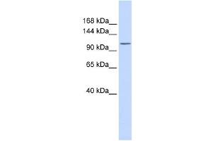 Western Blotting (WB) image for anti-ATPase, Ca++ Transporting, Plasma Membrane 3 (ATP2B3) (N-Term) antibody (ABIN634900)