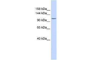ATP2B3 antibody used at 1 ug/ml to detect target protein. (ATP2B3 抗体  (N-Term))