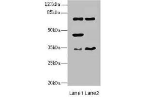 Western blot All lanes: EHF antibody at 4. (EHF 抗体  (AA 1-210))