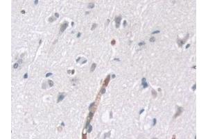 Detection of tPK1 in Human Cerebrum Tissue using Polyclonal Antibody to Tau-Protein Kinase 1 (tPK1) (TPK1 抗体  (AA 34-300))