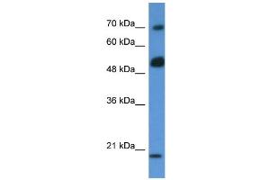 Western Blotting (WB) image for anti-rho GTPase Activating Protein 36 (ARHGAP36) (N-Term) antibody (ABIN2785083) (ARHGAP36 抗体  (N-Term))