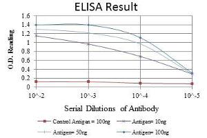 Red: Control Antigen (100 ng), Purple: Antigen (10 ng), Green: Antigen (50 ng), Blue: Antigen (100 ng), (SMN1 抗体)