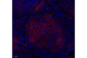 Immunofluorescence (Paraffin-embedded Sections) (IF (p)) image for anti-Protein Tyrosine Phosphatase G1 (PTPN12) antibody (ABIN7075292)