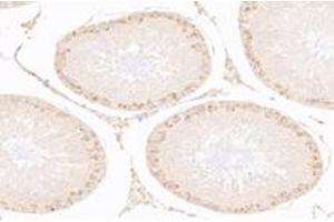 Immunohistochemistry analysis of paraffin-embedded rat testis using,IFNL3 (ABIN7074356) at dilution of 1: 2000 (IL28B 抗体)