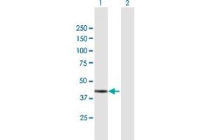 Western Blotting (WB) image for anti-Alcohol Dehydrogenase 7 (Class IV), mu Or sigma Polypeptide (ADH7) (AA 1-386) antibody (ABIN947539)