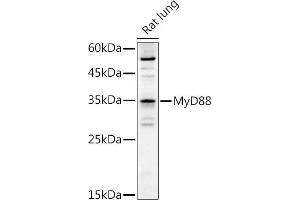 Western blot analysis of extracts of Rat lung, using MyD88 antibody (ABIN6128257, ABIN6144228, ABIN6144229 and ABIN6213986) at 1:1000 dilution. (MYD88 抗体  (AA 60-309))