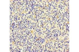 Immunohistochemistry of paraffin-embedded human spleen tissue using ABIN7171488 at dilution of 1:100 (TLN2 抗体  (AA 88-406))