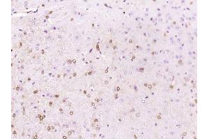 Paraformaldehyde-fixed, paraffin embedded mouse brain; Antigen retrieval by boiling in sodium citrate buffer (pH6) for 15min; Block endogenous peroxidase by 3% hydrogen peroxide for 30 minutes; Blocking buffer (normal goat serum) at 37°C for 20min; Antibody incubation with APBA1 Polyclonal Antibody, Unconjugated (bs-11334R)at 1:200 overnight at 4°C, followed by a conjugated secondary and DAB staining. (APBA1 抗体  (AA 451-550))