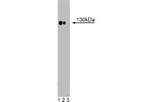 Western Blotting (WB) image for anti-Phospholipase C beta 4 (PLCb4) (AA 752-961) antibody (ABIN968583) (Phospholipase C beta 4 抗体  (AA 752-961))