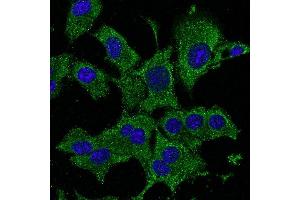 Immunofluorescence - anti-ATG12 Ab - Autophagosome Marker in Hepa1-6 cells at 1/50 dilution, cells were fixed With methanol, (ATG12 抗体  (N-Term))