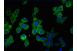 Immunofluorescence (IF) image for anti-Glial Fibrillary Acidic Protein (GFAP) (AA 292-432) antibody (ABIN7153847)
