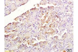 Formalin-fixed and paraffin embedded rat pancreas labeled with Anti-SDF-1/CXCL12 Polyclonal Antibody, Unconjugated (ABIN1386329) at 1:200 followed by conjugation to the secondary antibody and DAB staining