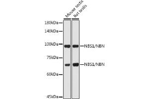 Western blot analysis of extracts of various cell lines, using NBS1/NBS1/NBN antibody (ABIN1681204, ABIN3015326, ABIN3015327 and ABIN5663771) at 1:1000 dilution. (Nibrin 抗体  (AA 435-754))