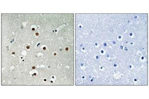Immunohistochemical analysis of paraffin-embedded human brain tissue using MEF2C (Phospho-Ser396) antibody (left)or the same antibody preincubated with blocking peptide (right). (MEF2C 抗体  (pSer396))