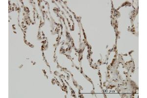 Immunoperoxidase of monoclonal antibody to NFKBIB on formalin-fixed paraffin-embedded human lung. (NFKBIB 抗体  (AA 56-145))