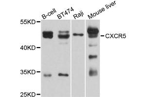 Western blot analysis of extracts of various cell lines, using CXCR5 antibody (ABIN5995664) at 1/1000 dilution. (CXCR5 抗体)