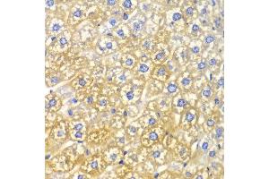 Immunohistochemistry of paraffin-embedded mouse liver using FASN antibody at dilution of 1:100 (400x lens). (Fatty Acid Synthase 抗体)