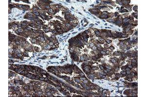 Image no. 4 for anti-CCR4-NOT Transcription Complex Subunit 4 (CNOT4) (AA 190-455) antibody (ABIN1491098)
