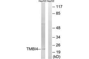 Western blot analysis of extracts from HepG2 cells, using TMBIM4 Antibody.