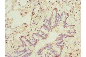 Immunohistochemistry of paraffin-embedded human lung tissue using ABIN7172635 at dilution of 1:100 (SOX5 抗体  (AA 1-120))