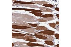 Immunohistochemical staining of human skeletal muscle with LOC653192 polyclonal antibody  shows strong cytoplasmic positivity in myocytes at 1:50-1:200 dilution. (TRIM43 抗体)