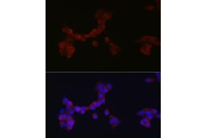Immunofluorescence analysis of SH-SY5Y cells using D Rabbit pAb (ABIN6130320, ABIN6139385, ABIN6139386 and ABIN6214572) at dilution of 1:250 (40x lens). (DAB1 抗体  (AA 1-185))