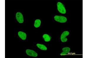 Immunofluorescence of monoclonal antibody to RAX on HeLa cell. (RAX 抗体  (AA 104-206))