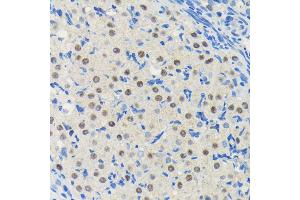 Immunohistochemistry of paraffin-embedded rat ovary using PIM1 antibody (ABIN7269375) at dilution of 1:100 (40x lens). (PIM1 抗体)