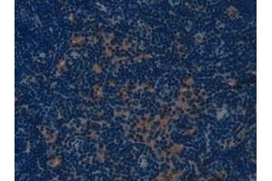 Immunohistochemistry (IHC) image for anti-Collagen, Type I, alpha 1 (COL1A1) (AA 1225-1453) antibody (ABIN7431647)