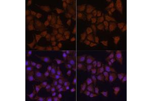 Immunofluorescence analysis of HeLa cells using MAP1LC3B antibody. (LC3B 抗体)