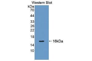 Western blot analysis of the recombinant protein. (Cytokeratin 7 抗体  (AA 394-457))