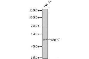 Western blot analysis of extracts of HepG2 cells using ENPP7 Polyclonal Antibody at dilution of 1:400. (ENPP7 抗体)