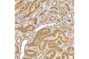 Immunohistochemistry (IHC) image for anti-ATP Citrate Lyase (ACLY) (AA 752-1101) antibody (ABIN7265716)