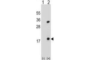 Western Blotting (WB) image for anti-Phospholipase A2, Group IB (PLA2G1B) antibody (ABIN3002154) (PLA2G1B 抗体)