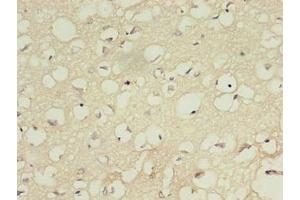 Immunohistochemistry of paraffin-embedded human brain tissue using ABIN7156983 at dilution of 1:100 (RABL4 抗体  (AA 1-186))