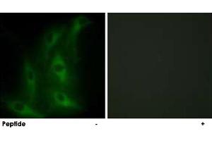 Immunofluorescence analysis of HeLa cells, using COL4A6 polyclonal antibody . (COL4a6 抗体)