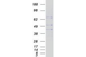 Validation with Western Blot