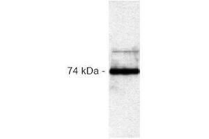 Western Blotting (WB) image for anti-V-Raf-1 Murine Leukemia Viral Oncogene Homolog 1 (RAF1) antibody (ABIN126882) (RAF1 抗体)